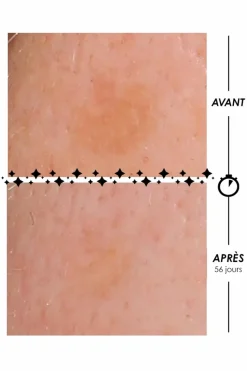 Crème lactée anti-taches La Foudroyante Eclair de Lune à l’advanced Retinol-Like