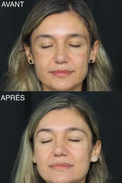 Fluide anti-taches haute protection SPF30