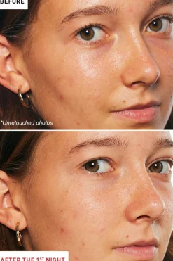 Huile de nuit multi-perfectrice Skin Therapy