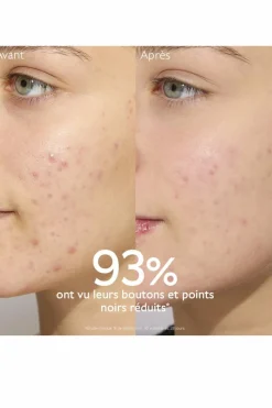 Kit anti-acné Vinopure