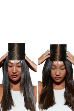 Micro-peeling cellulaire anti-pelliculaire Symbiose