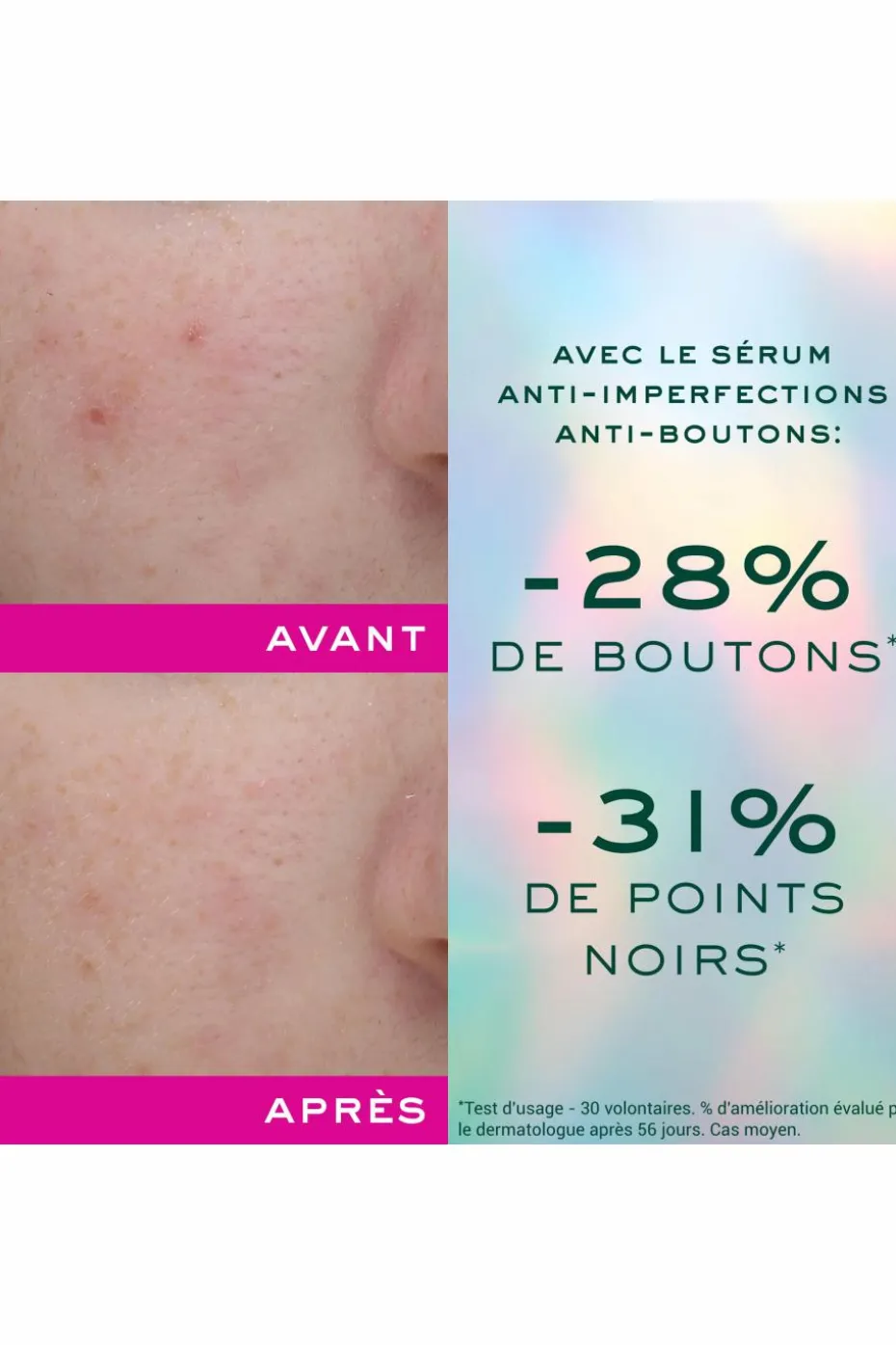 Sérum anti-imperfections & anti-boutons Zinc Power