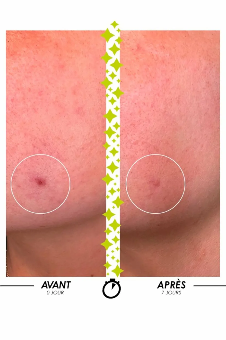 Sérum anti-imperfections concentré Elixir du Marabout®