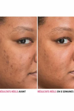 Sérum anti-taches à la niacinamide Bye Bye Serum