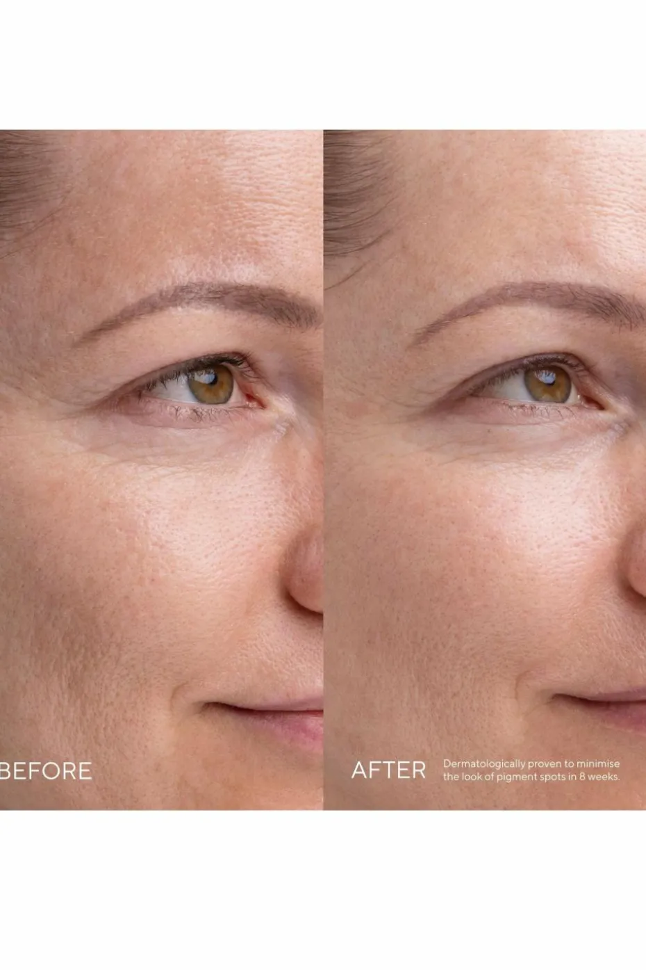 Sérum anti-taches Kojic alternative