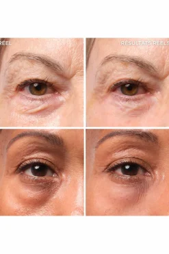 Traitement pour les poches  Bye Bye Under Eye Bags